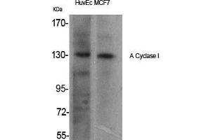 Western Blot (WB) analysis of specific cells using A Cyclase I Polyclonal Antibody. (ADCY1 Antikörper  (Internal Region))
