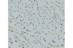 IHC analysis of RPA32/RPA2 using anti-RPA32/RPA2 antibody (ABIN7601379). (RPA2 Antikörper  (AA 34-254))