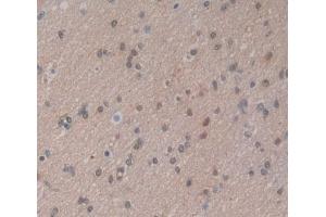 Immunohistochemistry (IHC) image for anti-Nuclear Receptor Subfamily 4, Group A, Member 2 (NR4A2) (AA 1-335) antibody (ABIN7443800)
