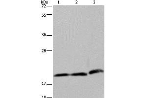 Western Blot analysis of Hela and K562 cell, Human fetal liver tissue using PGLYRP1 Polyclonal Antibody at dilution of 1:200 (PGLYRP1 Antikörper)