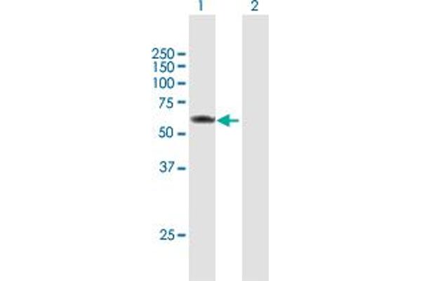 PRPF4 Antikörper  (AA 1-522)