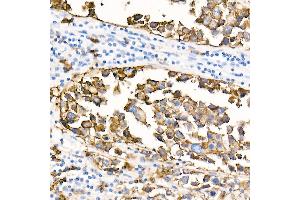 Immunohistochemistry (IHC) image for anti-Membrane-Spanning 4-Domains, Subfamily A, Member 1 (MS4A1) antibody (ABIN7268472)