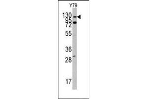 Image no. 1 for anti-C-Abl Oncogene 1, Non-Receptor tyrosine Kinase (ABL1) (N-Term) antibody (ABIN359967) (ABL1 Antikörper  (N-Term))