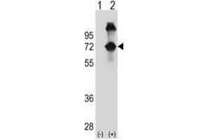 Western Blotting (WB) image for anti-Alveolar Soft Part Sarcoma Chromosome Region, Candidate 1 (ASPSCR1) (AA 64-93), (N-Term) antibody (ABIN950541)