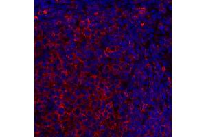 Immunofluorescence (IF) image for anti-HLA-DR (HLA-DR) antibody (ABIN7449537) (HLA-DR Antikörper)