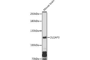 Western blot analysis of extracts of Mouse brain, using DLG antibody (ABIN7266791) at 1:1000 dilution. (DLGAP3 Antikörper  (AA 1-100))