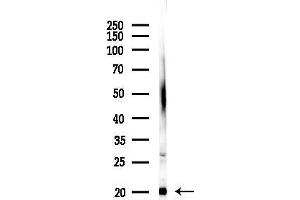anti-Signal Peptidase Complex Subunit 3 Homolog (SPCS3) antibody