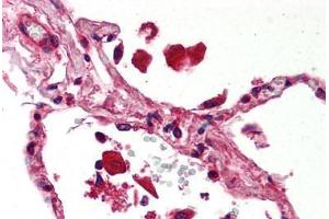 Human Lung (formalin-fixed, paraffin-embedded) stained with STAT1 antibody ABIN239822 at 5 ug/ml followed by biotinylated anti-mouse IgG secondary antibody ABIN481714, alkaline phosphatase-streptavidin and chromogen. (STAT1 Antikörper)