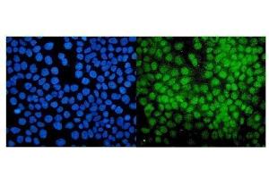 IF analysis of PIAS1 using anti-PIAS1 antibody (ABIN7602694). (PIAS1 Antikörper  (AA 96-300))