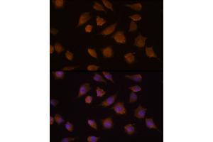Immunofluorescence analysis of L929 cells using COMP Rabbit pAb (ABIN6127649, ABIN6138863, ABIN6138865 and ABIN6218152) at dilution of 1:100 (40x lens). (COMP Antikörper  (AA 20-160))