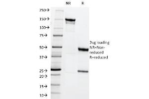 SDS-PAGE Analysis Purified MRP1 Mouse Monoclonal Antibody (MRP1/1344). (ABCC1 Antikörper)