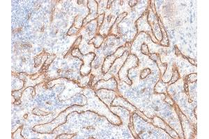 Immunohistochemistry (IHC) image for anti-Catenin (Cadherin-Associated Protein), beta 1, 88kDa (CTNNB1) antibody (ABIN6939211)