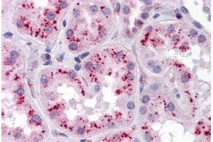 Human Kidney: Formalin-Fixed, Paraffin-Embedded (FFPE) (ZMYM4 Antikörper  (C-Term))