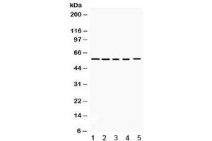 Western blot testing of 1) rat brain, 2) mouse brain, human 3) K562, 4) HeLa and 5) 22RV1 lysate with KCNA3 antibody.