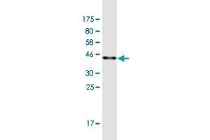 Western Blotting (WB) image for anti-Microtubule Associated Monoxygenase, Calponin and LIM Domain Containing 3 (MICAL3) (AA 251-340) antibody (ABIN949539)