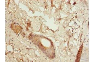 Immunohistochemistry of paraffin-embedded human skin tissue using ABIN7153448 at dilution of 1:100