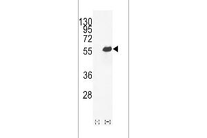 Western blot analysis of OPN-a/b (arrow) using rabbit polyclonal OPN-a/b Antibody (N-term) (ABIN655514 and ABIN2845029). (OPN-A,b (AA 14-40), (N-Term) Antikörper)