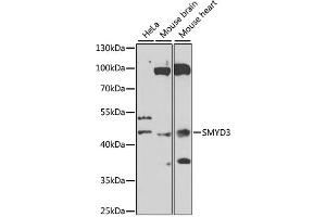 Western blot analysis of extracts of various cell lines, using SMYD3 antibody (ABIN6128709, ABIN6148169, ABIN6148170 and ABIN6223146) at 1:1000 dilution. (SMYD3 Antikörper  (AA 140-369))