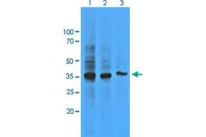 Western Blot analysis of HepG2 cell lysate (Lane 1: 1:500, Lane 2: 1:1000 and Lane 3: 1:5000) with AKR1C1 monoclonal antibody, clone AT6D10 . (AKR1C1 Antikörper)