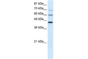 PRMT3 antibody used at 0. (PRMT3 Antikörper  (Middle Region))