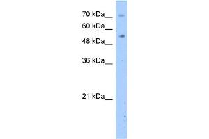 WB Suggested Anti-DPYS Antibody Titration:  2. (DPYS Antikörper  (N-Term))