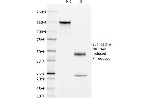 SDS-PAGE Analysis Purified Superoxide Dismutase 1 Mouse Monoclonal Antibody (SOD1/2089). (SOD1 Antikörper)