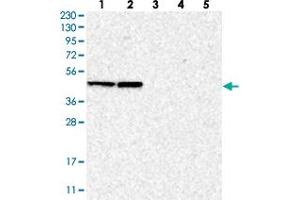 Western blot analysis of Lane 1: RT-4, Lane 2: U-251 MG, Lane 3: Human Plasma, Lane 4: Liver, Lane 5: Tonsil with BXDC5 polyclonal antibody . (RPF1 Antikörper)