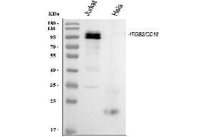 Western blot analysis of CD18/ITGB2 using anti-CD18/ITGB2 antibody (ABIN3043260).
