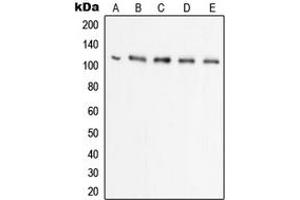 Western blot analysis of UBA7 expression in Raji (A), HL60 (B), HeLa (C), THP1 (D), A549 (E) whole cell lysates. (UBA7 Antikörper  (C-Term))