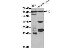 Western blot analysis of extracts of various cell lines, using F10 antibody. (Coagulation Factor X Antikörper)