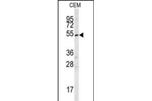 Western blot analysis of SMYD3 antibody (Center) (ABIN6242627 and ABIN6578989) in CEM cell line lysates (35 μg/lane). (SMYD3 Antikörper  (AA 209-236))