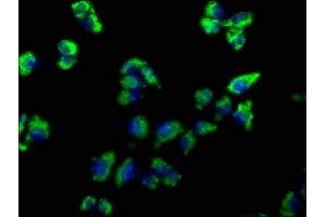 Immunofluorescence staining of Hela cells with ABIN7139819 at 1:66, counter-stained with DAPI. (EMC4 Antikörper  (AA 43-60))