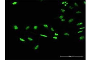Immunofluorescence of purified MaxPab antibody to GTF2E1 on HeLa cell. (GTF2E1 Antikörper  (AA 1-439))