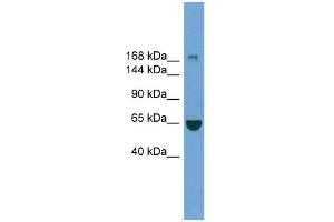 WB Suggested Anti-ZCCHC11 Antibody Titration: 0. (ZCCHC11 Antikörper  (Middle Region))