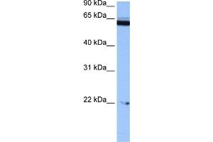 WB Suggested Anti-C14orf174 Antibody Titration: 0. (C14orf174 Antikörper  (N-Term))