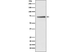 Western blot analysis of Cdc16/APC6 expression in HepG2 cell lysate. (Rekombinanter CDC16 Antikörper)