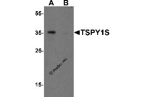 Western Blotting (WB) image for anti-TSPY1S (C-Term) antibody (ABIN1077409) (TSPY1S (C-Term) Antikörper)