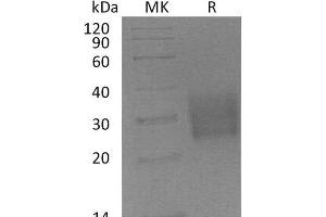 Western Blotting (WB) image for Transforming Growth Factor, beta Receptor II (70/80kDa) (TGFBR2) protein (His tag) (ABIN7320670) (TGFBR2 Protein (His tag))