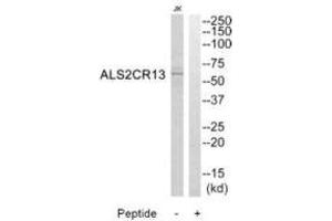 Western blot analysis of extracts from Jurkat cells, using ALS2CR13 antibody. (FAM117B Antikörper  (C-Term))