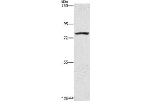 Western blot analysis of K562 cell, using SENP1 Polyclonal Antibody at dilution of 1:1500 (SENP1 Antikörper)