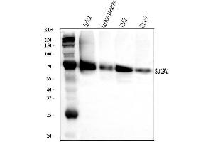 Western blot analysis of RFC/SLC19A1 using anti-RFC/SLC19A1 antibody (ABIN7600455).