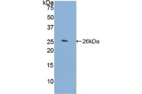 FLNC Antikörper  (AA 2519-2725)