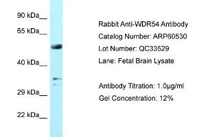 Western Blotting (WB) image for anti-WD Repeat Domain 54 (WDR54) (Middle Region) antibody (ABIN2788483) (WDR54 Antikörper  (Middle Region))