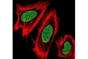 Fluorescent confocal image of HeLa cells stained with UHRF1 antibody.