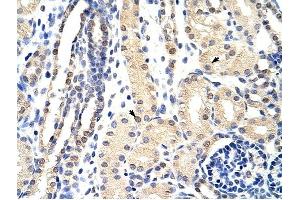 EXOSC3 antibody was used for immunohistochemistry at a concentration of 4-8 ug/ml to stain Epithelial cells of renal tubule (arrows) in Human Kidney. (EXOSC3 Antikörper  (C-Term))