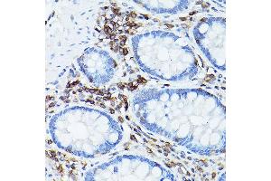 Immunohistochemistry of paraffin-embedded human colon using CD45 Rabbit pAb (ABIN3022953, ABIN3022954, ABIN3022955, ABIN1513451 and ABIN6219315) at dilution of 1:50 (40x lens). (CD45 Antikörper  (AA 890-990))
