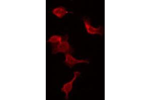 ABIN6272461 staining NIH-3T3 by IF/ICC. (WASF1 Antikörper  (Internal Region))