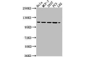 Western Blot Positive WB detected in: HeLa whole cell lysate, MCF-7 whole cell lysate, 293T whole cell lysate, PC3 whole cell lysate, L02 whole cell lysate All lanes: CSE1L antibody at 1:2000 Secondary Goat polyclonal to rabbit IgG at 1/50000 dilution Predicted band size: 111, 23, 108, 104 kDa Observed band size: 111 kDa (Exportin 2 Antikörper  (AA 713-971))