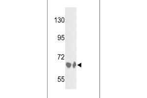 Western blot analysis of BF Antibody (Center) (ABIN391536 and ABIN2841487) in HepG2 cell line and mouse liver tissue lysates (35 μg/lane). (Complement Factor B Antikörper  (Center))