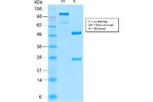 SDS-PAGE Analysis of Purified Insulin Receptor Rabbit Recombinant Monoclonal Antibody (INSR/2277R). (Rekombinanter Insulin Receptor Antikörper  (Extracellular Domain))